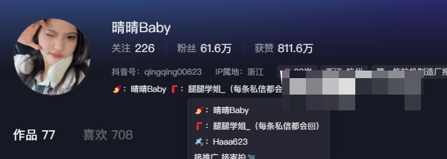 腿腿学姐微密圈资源图片（晴晴Baby定制图片分享）-1
