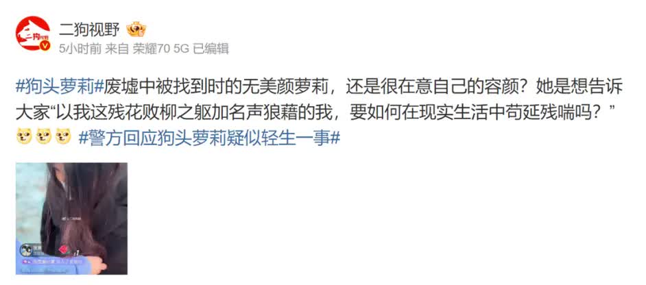 网红狗头萝莉退网 称要走出阴影重新开始生活-1