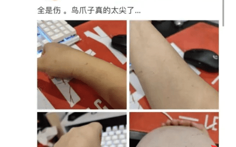 茶杯不泡tea超大车灯作品资源，被鸟抓伤的丰满妹子
